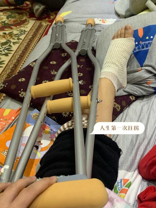 骨折长期卧床后第一次下床,该如何避免头晕,骨折以后为什么总想吐呢。 SEO关键词 骨折长期卧床后第一次下床,该如何避免头晕,骨折以后为什么总想吐呢。 骨折长期卧床后第一次下床,该如何避免头晕,骨折以后为什么总想吐呢。 SEO关键词