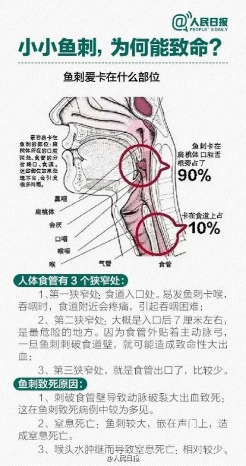 肇庆seo鱼刺体系排名_后怕一根鱼刺花了50多万年夜夫提醒这种情况下别吃鱼 搜狗SEO 肇庆seo鱼刺体系排名_后怕一根鱼刺花了50多万年夜夫提醒这种情况下别吃鱼 肇庆seo鱼刺体系排名_后怕一根鱼刺花了50多万年夜夫提醒这种情况下别吃鱼 搜狗SEO