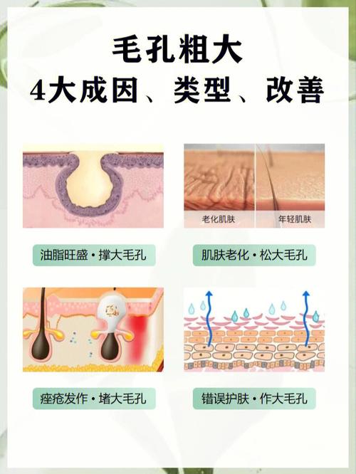 介绍角区毛孔特别大的秘密,成因、影响及改善方法 百度SEO 介绍角区毛孔特别大的秘密,成因、影响及改善方法 介绍角区毛孔特别大的秘密,成因、影响及改善方法 百度SEO
