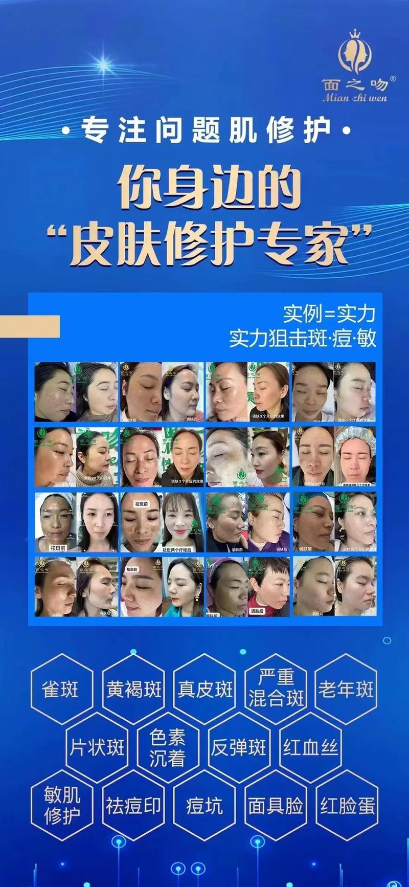 探索皮肤设计师的魔法世界,打造个性化美肤方法 必应SEO 探索皮肤设计师的魔法世界,打造个性化美肤方法 探索皮肤设计师的魔法世界,打造个性化美肤方法 必应SEO